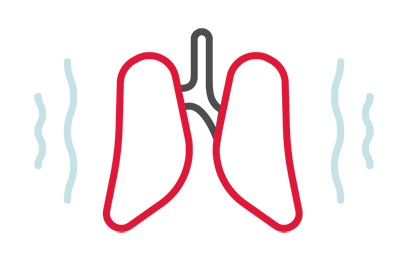 PULMONES SANOS